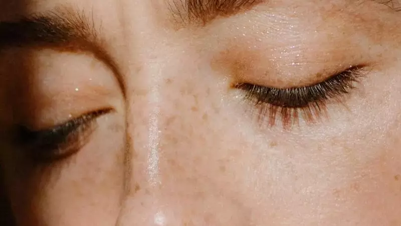 Blefaroplastia: Un renacer para tu mirada